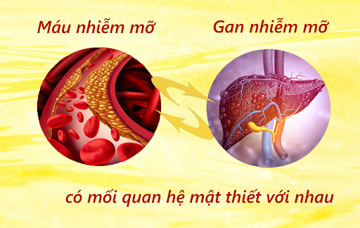 pqa mỡ máu hỗ trợ hạ mỡ máu, hạ mỡ gan và bảo vệ gan