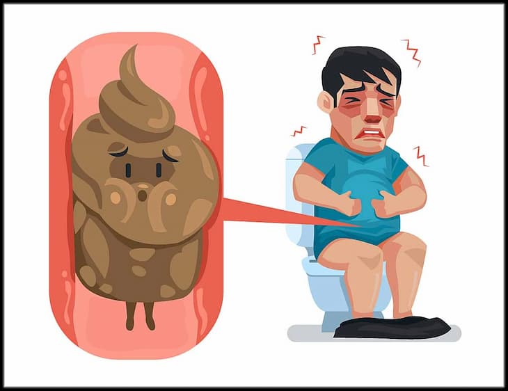 Són phân ở trẻ nhỏ: Đừng chủ quan khi táo bón kéo dài